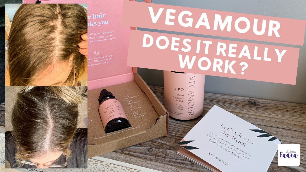 Does Vegamour Really Work? BEFORE and AFTER 4 month test!