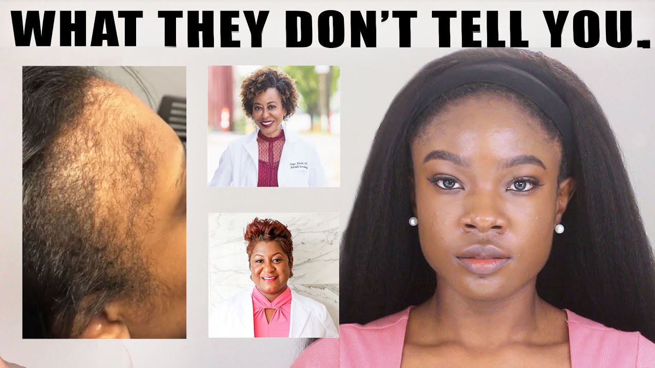 How to Actually Grow EDGES BACK| Real Dermatologist Tell All