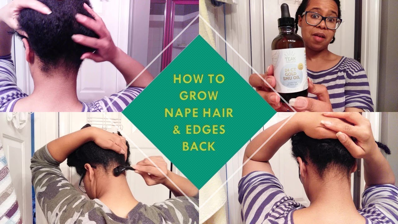 Grow Nape Hair & Edges Naturally (Emu Oil & Derma Roller)