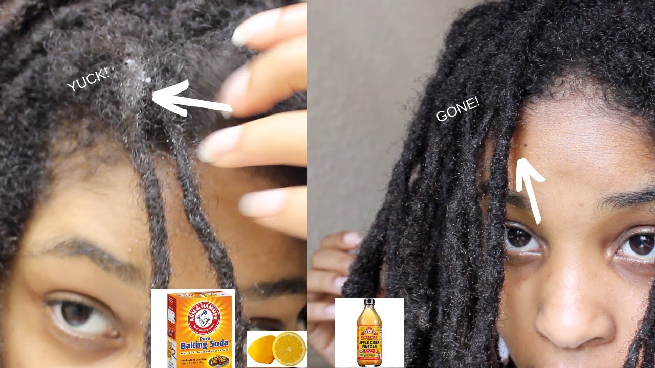 ACV Rinse for DIRTY LOCS: Great Results!