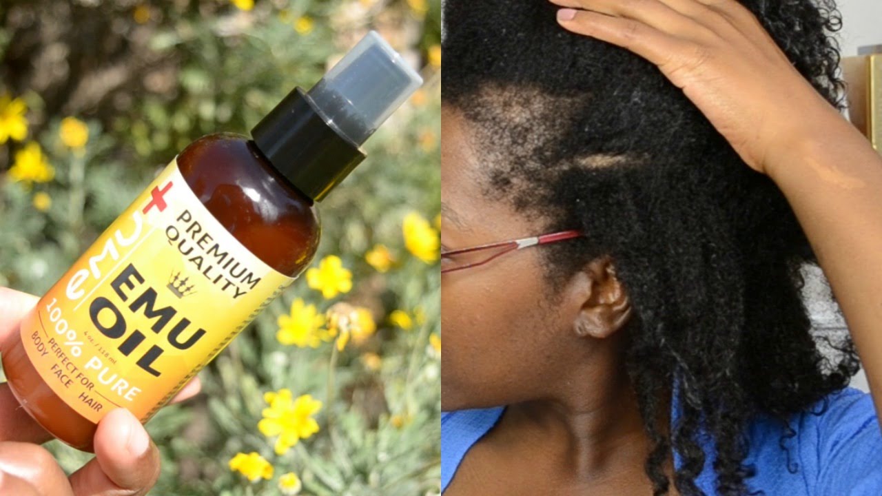 EMU OIL FOR TRACTION ALOPECIA, BALD SPOT AND THIN EDGES: HOW TO GROW BACK YOUR EDGES