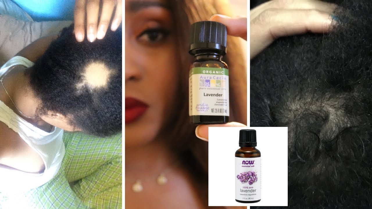 Lavender Oil For Hair Growth? | Lavender Oil For Hair Growth Results