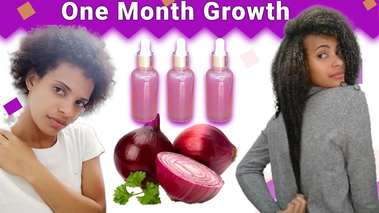 Onion Juice For Hair Growth 😱BEFORE AND AFTER RESULTS