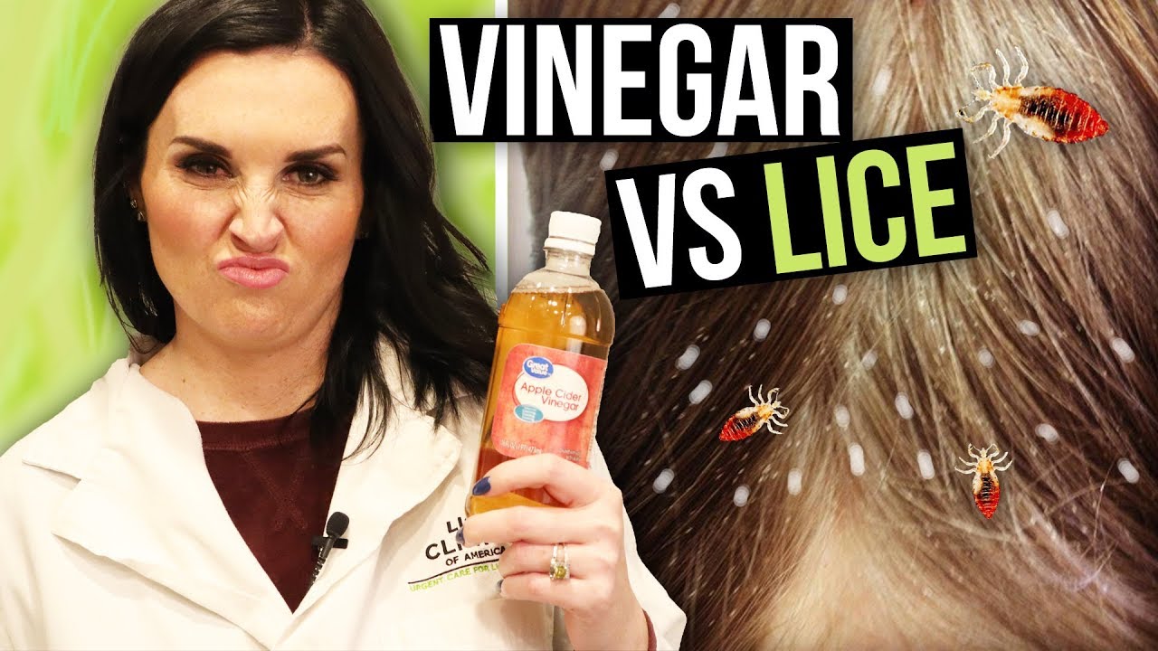Apple Cider Vinegar for Head Lice Removal - Watch BEFORE You Try!