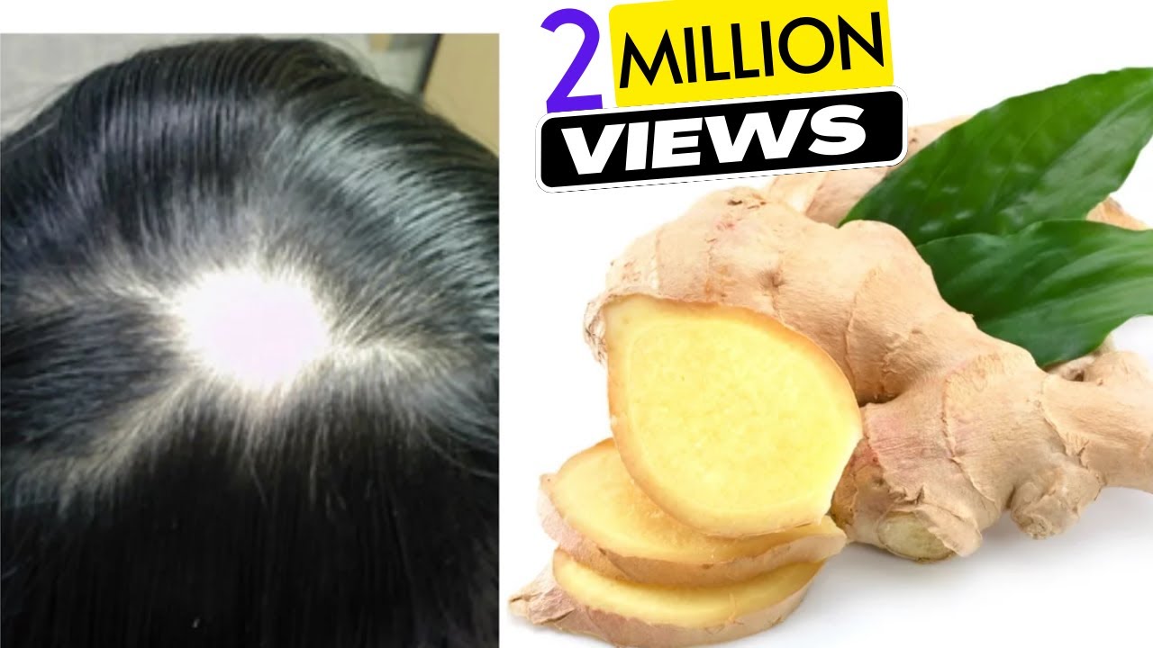 Ginger Juice to Cure Baldness & Regrow New Hair | Sushmita's Diaries