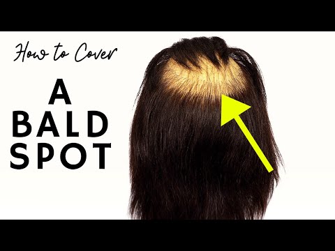 How to Fix a Bald Spot - TheSalonGuy