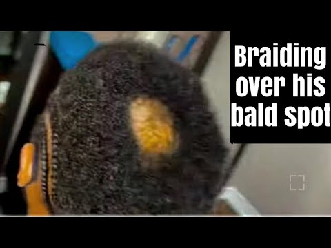 Braiding over his bald spot / very short hair / covering his bald spot / men protective style