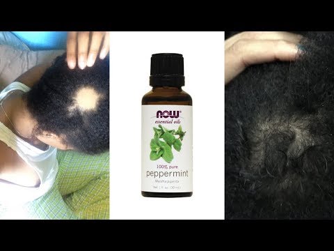 Peppermint Oil For Hair Growth Results