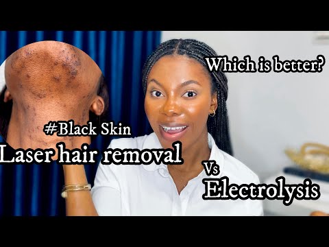 Laser hair Versus Electrolysis of hair removal on black skin | Understanding facial hair .