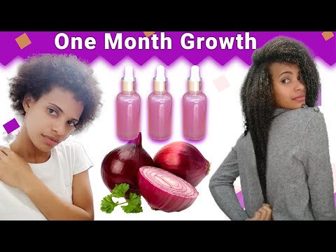 Onion Juice For Hair Growth 😱BEFORE AND AFTER RESULTS