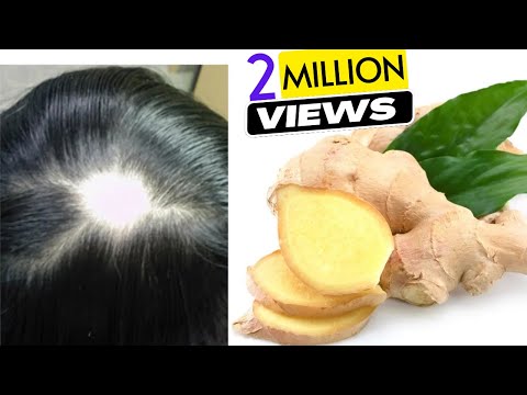 Ginger Juice to Cure Baldness &amp; Regrow New Hair | Sushmita's Diaries
