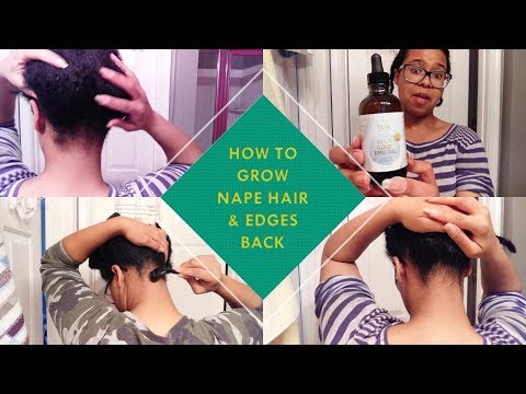 Grow Nape Hair &amp; Edges Naturally (Emu Oil &amp; Derma Roller)