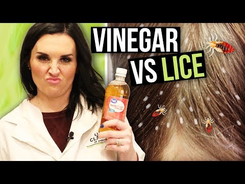 Apple Cider Vinegar for Head Lice Removal - Watch BEFORE You Try!