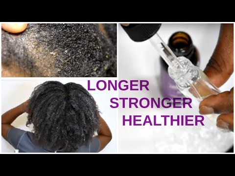 10 Lavender Oil Benefits for Natural Hair GROWTH &amp; SCALP REPAIR | Naturenics