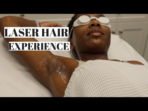 Underarm LASER HAIR REMOVAL| On Dark Skin!