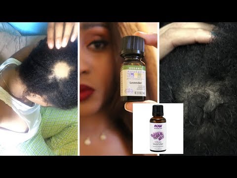 Lavender Oil For Hair Growth? | Lavender Oil For Hair Growth Results