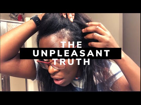 The Unpleasant TRUTH | Wave Nouveau Hair Loss