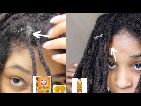 ACV Rinse for DIRTY LOCS: Great Results!