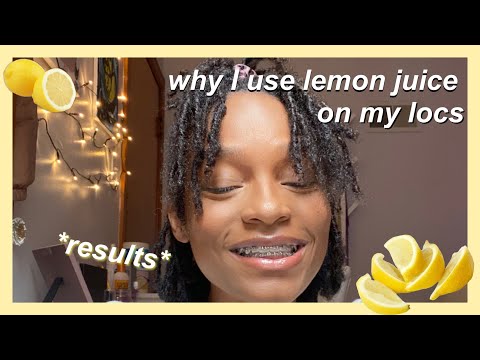 LEMON JUICE ON STARTER LOCS | Tips to loc hair faster?!