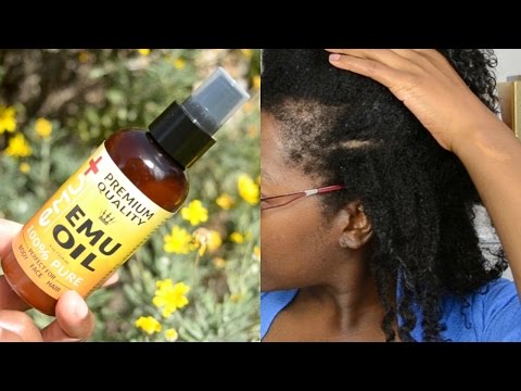 EMU OIL FOR TRACTION ALOPECIA, BALD SPOT AND THIN EDGES: HOW TO GROW BACK YOUR EDGES