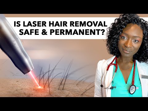 Is Laser Hair Removal Permanent, Safe, Worth It? Dark Skin, Side Effects, Cancer, Home Lasers, Burns
