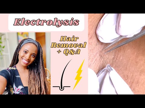 Electrolysis PERMANENT HAIR REMOVAL | Watch me get treated + Questions &amp; Answers