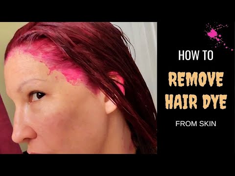 HOW TO REMOVE HAIR DYE STAIN FROM SKIN INSTANTLY// Fastest way to get hair dye off skin!