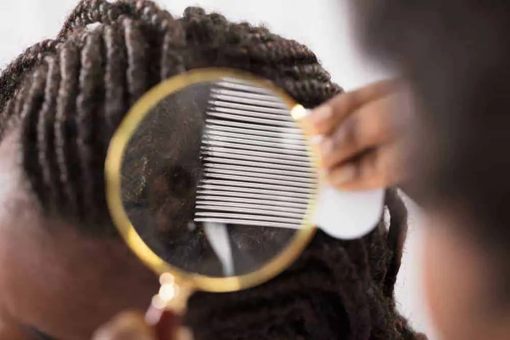 African American female with a flaky scalp that uses the Curly Girl Method