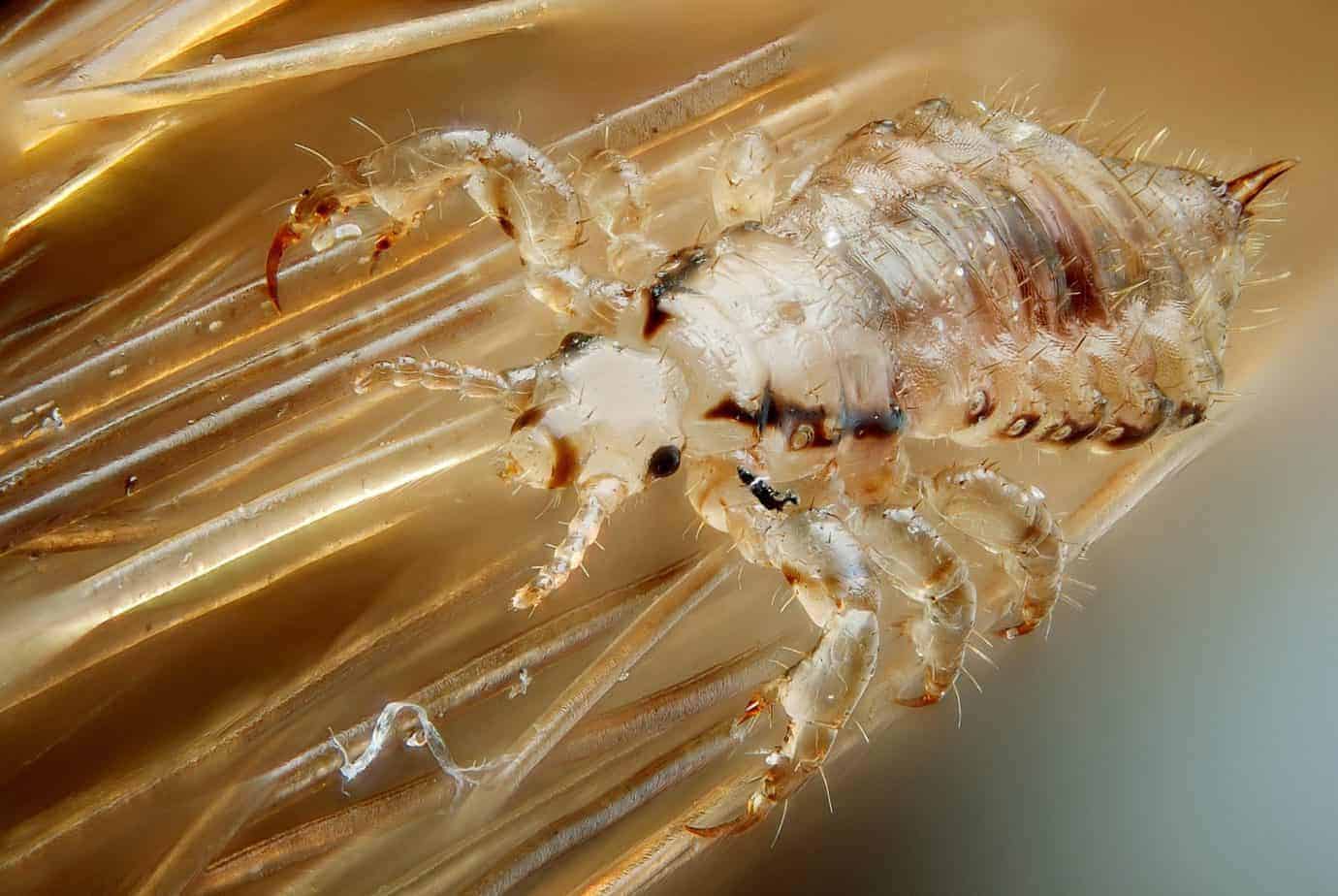 head lice