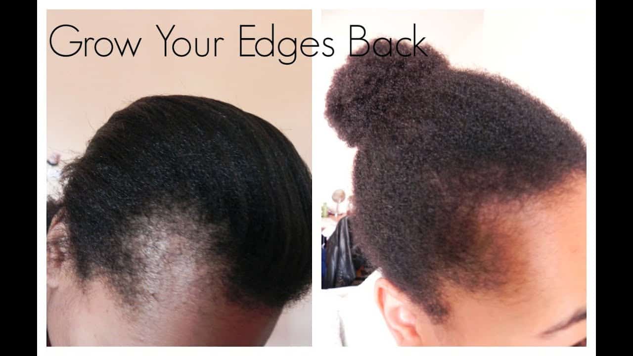 How to Use Emu Oil for Hair Loss and Hair Growth: DIY Guide