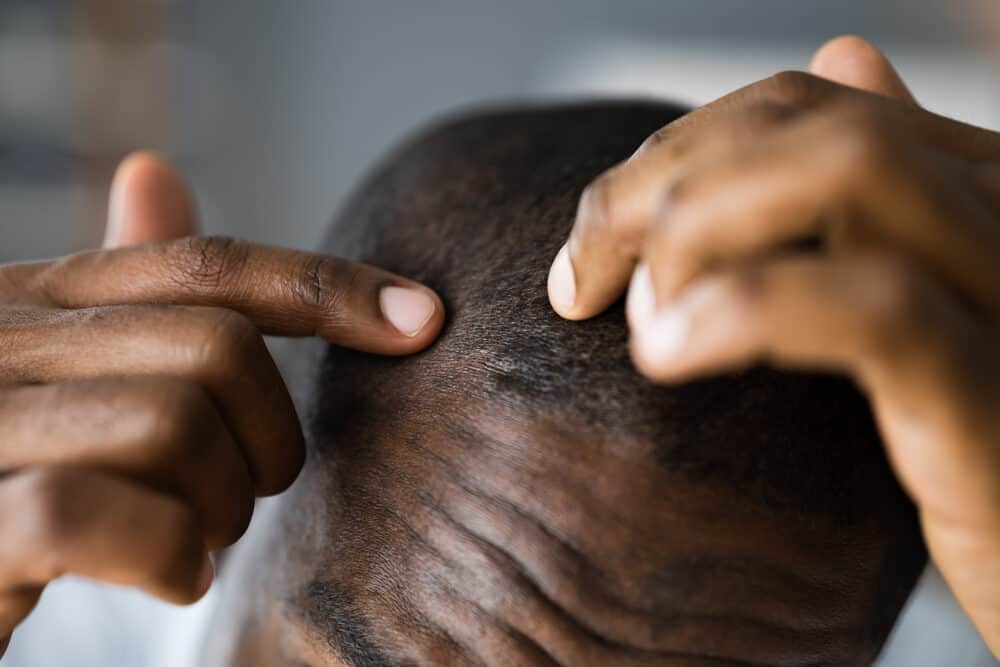 Young black man with curly hair strands hoping not to lose hair from constantly wearing wave caps and silk durags.