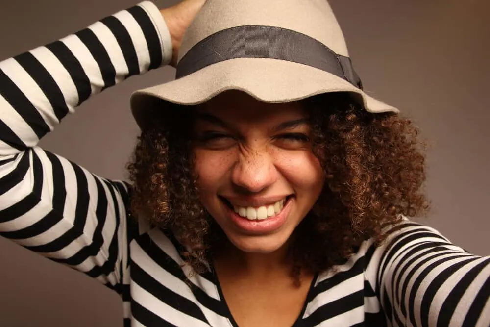 Does Wearing a Hat Cause Dandruff? Baseball cap? Everyday? 3 Light-skinned African female that wears flat caps for lengthy periods as part of her winter and summer styles.