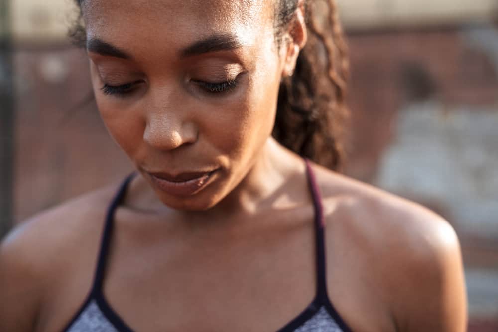 A dark-skinned black female that had an allergic reaction to a hair product after working out and sweating.