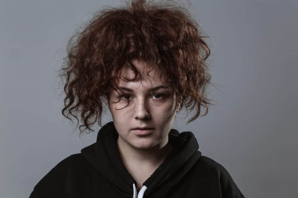 How to Fix Dead Hair Follicles at Home Without Cutting It Curlystyly