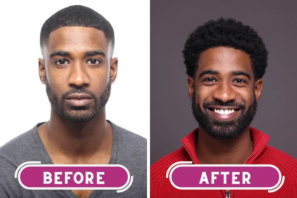 A black with thicker hair showing before and after photos of hair and beard growth after using beard balm.