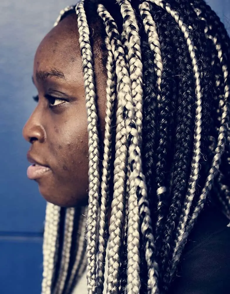 Weave Breaking My Face Out: How Extensions Can Cause Acne 3 A black woman with fresh pimples and long hair in a protective style covering her natural hair.